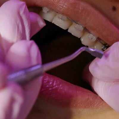 Estudiar Máster en Higienista Dental