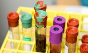 Descubre qué significan los linfocitos altos y neutrófilos bajos en una analítica de sangre