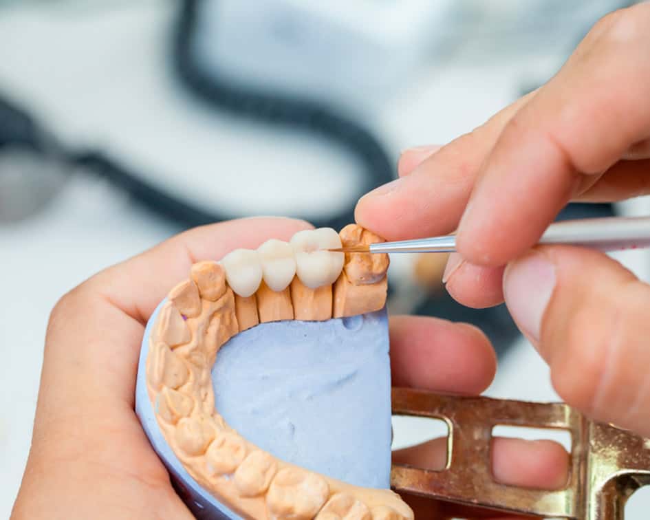 tecnico protesis dental a distancia tecnico protesis dental a distancia
