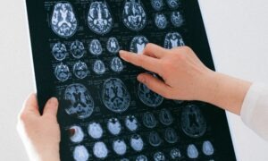 Conoce las salidas profesionales de la neuropsicología