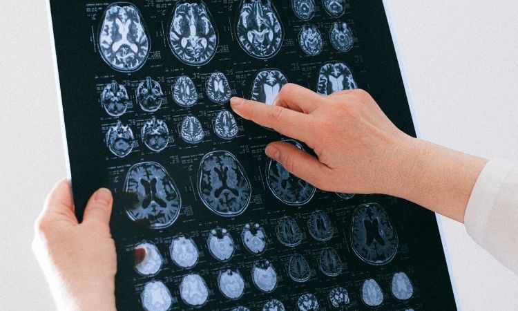 ¿Qué salidas profesionales tiene la neuropsicología?