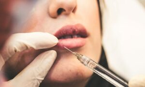 Conoce las últimas novedades en estética y medicina estética